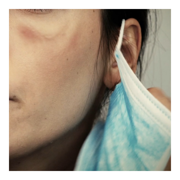 Face Mask Damage Solution